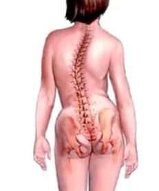 Patológia muskuloskeletálneho systému