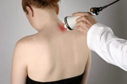 Liečba cervikálnej osteochondrózy laserovou terapiou