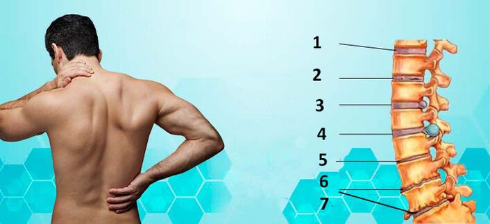 štádia vývoja osteochondrózy